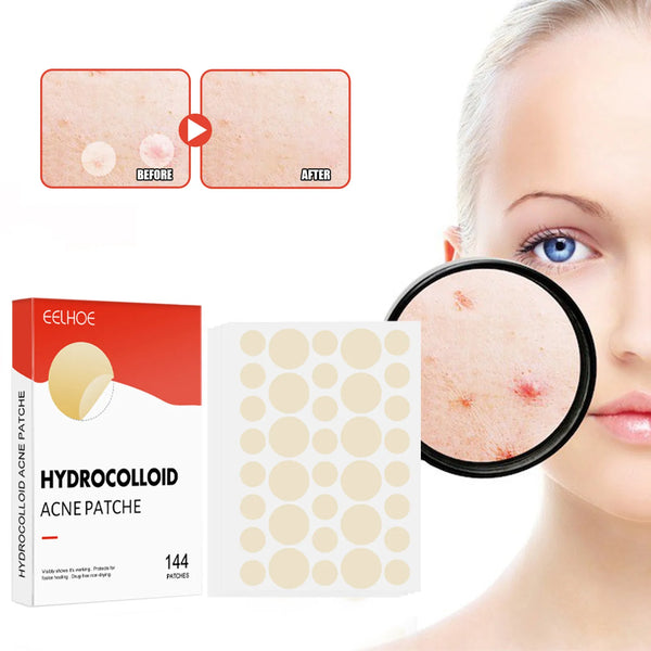 Invisible Acne Healing Patches